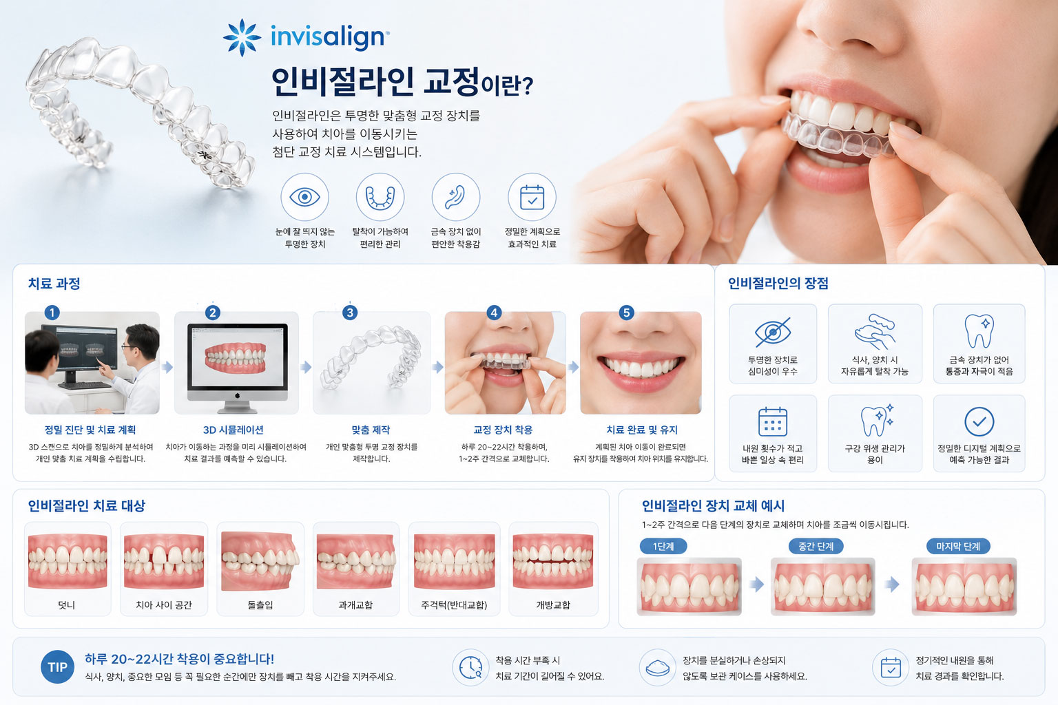 인천논현역 인비절라인 투명교정 얼라이너 장치 설명