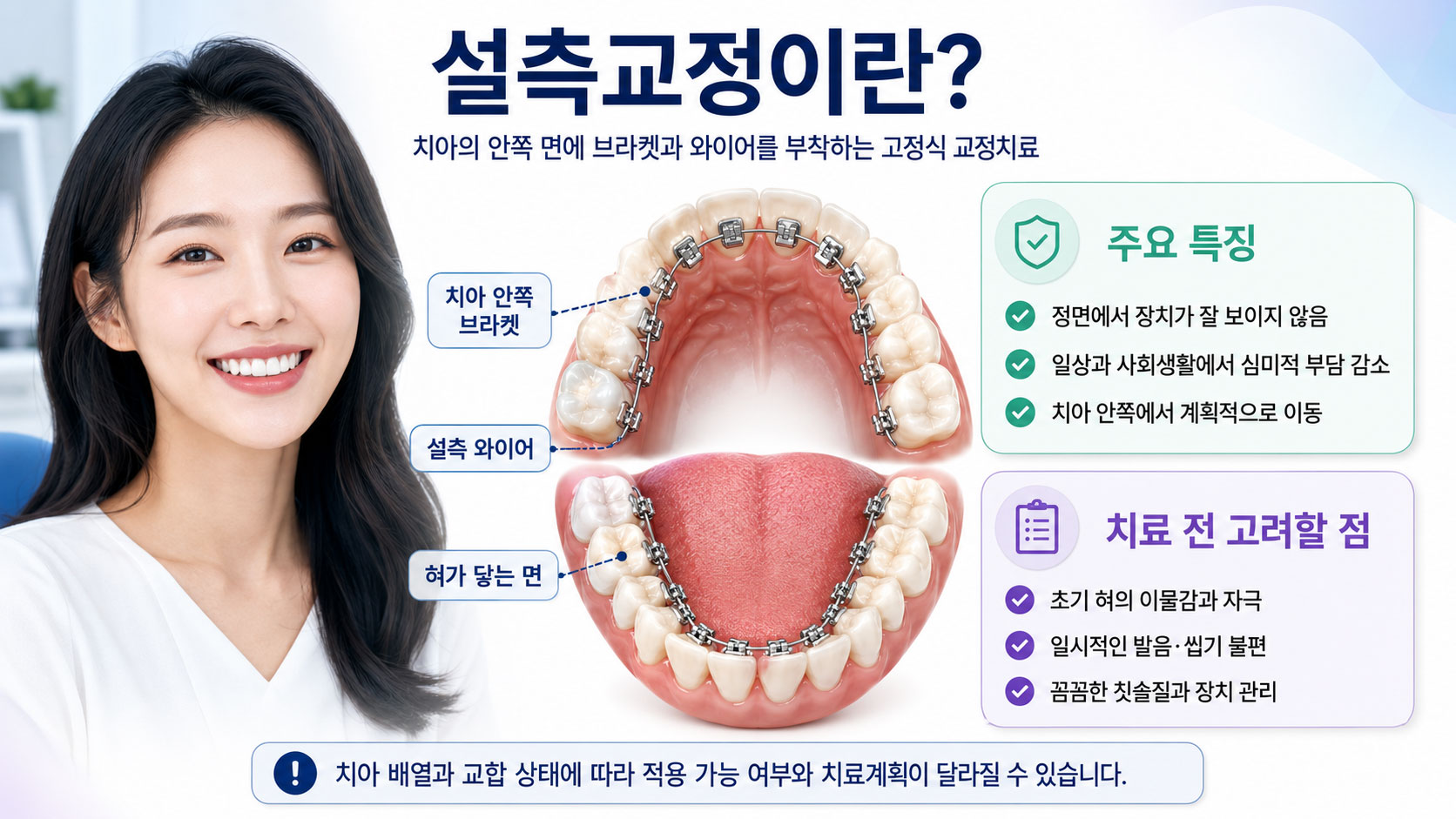 인천논현역 설측교정 치아 안쪽 부착 보이지 않는 교정 장치 설명